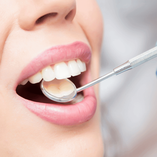 profilaktyka stomatologiczna